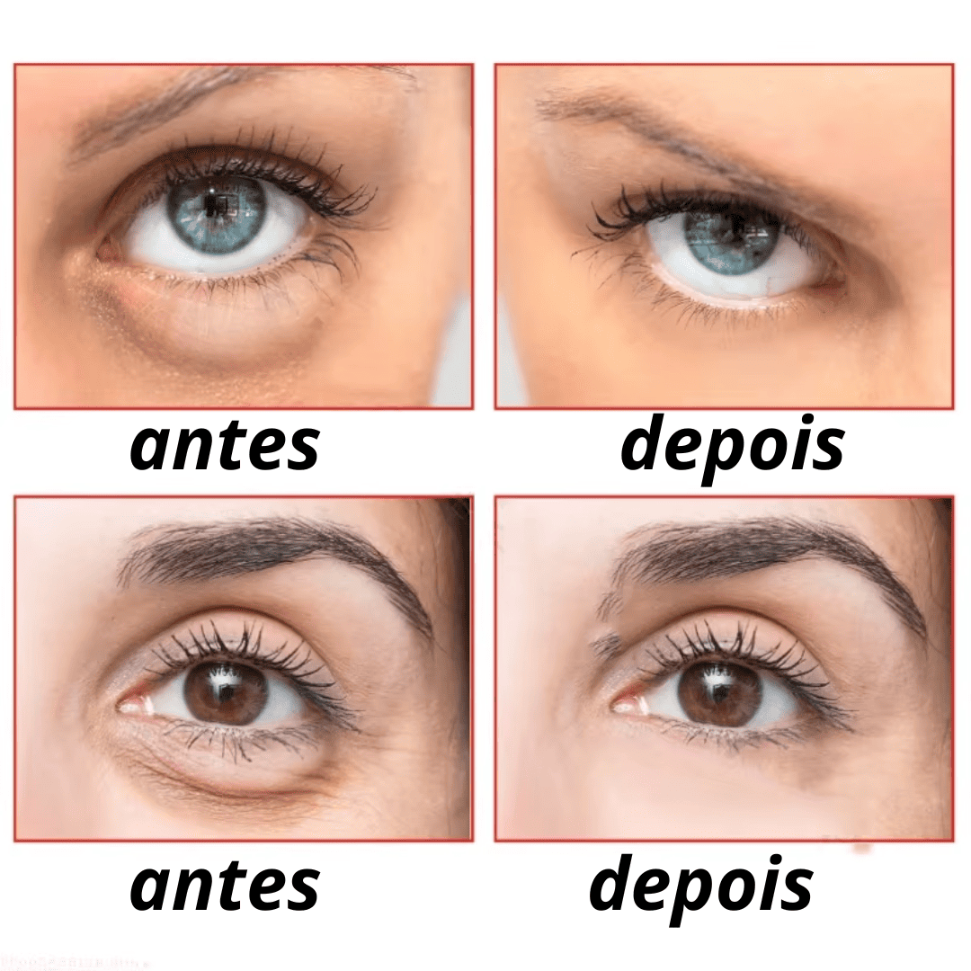 Luteina GLOW Rolon 5 em 1 ultra  - Rejuvenescedor
