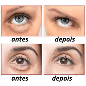  Luteina GLOW Rolon 5 em 1 ultra  - Rejuvenescedor